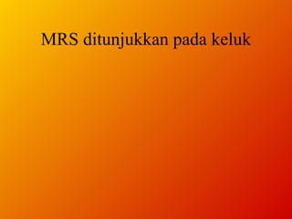 MRS ditunjukkan pada keluk 