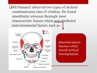 McNamara5 observed two types of skeletal
combinationsin class II children. He found
mandibular retrusion thesingle most
characteristic feature which was attributed
toenvironmental factors such as :
abnormal muscle
function which
altered occlusal
interdigitations.
 