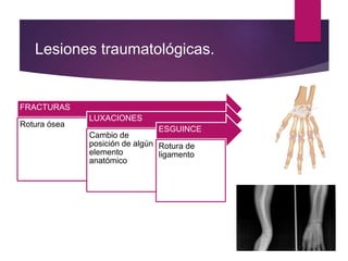 FRACTURAS
Rotura ósea
LUXACIONES
Cambio de
posición de algún
elemento
anatómico
ESGUINCE
Rotura de
ligamento
Lesiones traumatológicas.
 