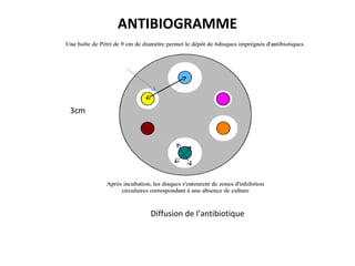 ANTIBIOGRAMME




3cm




         Diffusion de l’antibiotique
 