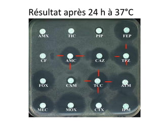 Résultat après 24 h à 37°C
 