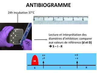 ANTIBIOGRAMME
24h incubation 37°C




                      Lecture et interprétation des
                      diamètres d’inhibition: comparer
                      aux valeurs de référence (d et D)
                      S–I-R
 
