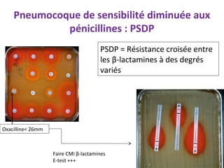Pneumocoque de sensibilité diminuée aux
             pénicillines : PSDP
                                      PSDP = Résistance croisée entre
                                      les β-lactamines à des degrés
                                      variés




Oxacilline< 26mm



                   Faire CMI β-lactamines
                   E-test +++
 