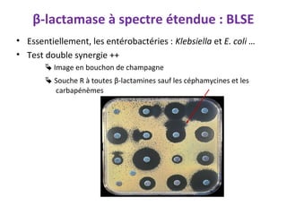β-lactamase à spectre étendue : BLSE
• Essentiellement, les entérobactéries : Klebsiella et E. coli …
• Test double synergie ++
        Image en bouchon de champagne
        Souche R à toutes β-lactamines sauf les céphamycines et les
         carbapénèmes
 