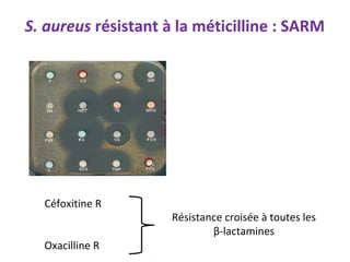 S. aureus résistant à la méticilline : SARM




  Céfoxitine R
                     Résistance croisée à toutes les
                             β-lactamines
  Oxacilline R
 