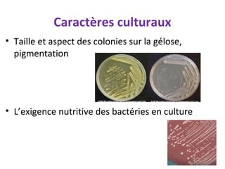 Caractères culturaux
• Taille et aspect des colonies sur la gélose,
  pigmentation




• L’exigence nutritive des bactéries en culture
 