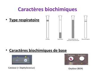 Caractères biochimiques
• Type respiratoire




• Caractères biochimiques de base



 Catalase (+ Staphylococcus)        Oxydase (BGN)
 