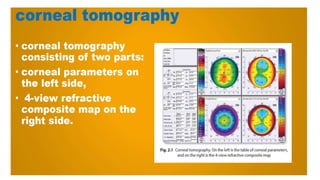 Topography and Tomography of cornea in detail | PPTX