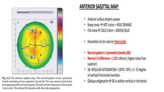 Topography Scan Topography and Tomography of cornea in detail | PPTX