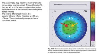 Pachy Numbers Topography and Tomography of cornea in detail | PPTX