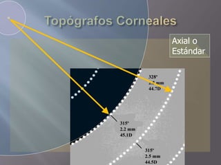 Axial o
Estándar
 