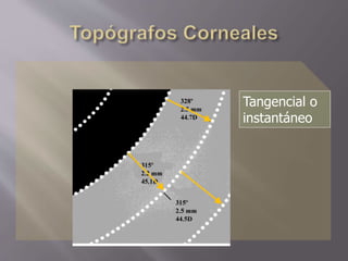 Tangencial o
instantáneo
 