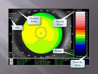 Nombre
Fecha
Ojo
Tipo de
Mapa
Escala
Nivel de
Inicio
 