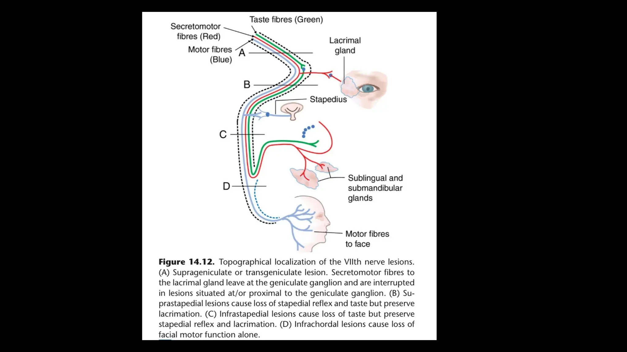 Topodiagnostic and electrophysiological tests of facial nerve .pptx