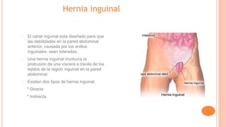 Hernia inguinal
El canal inguinal esta diseñado para que
las debilidades en la pared abdominal
anterior, causada por los anillos
inguinales, sean toleradas.
Una hernia inguinal involucra la
protrusión de una víscera a través de los
tejidos de la región inguinal en la pared
abdominal.
Existen dos tipos de hernia inguinal:
* Directa
* Indirecta
 