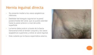 Hernia inguinal directa
▪ Se presenta medial a los vasos epigástricos
inferiores.
▪ Debilidad del triangulo inguinal en la pared
posteromedial del canal, que se puede extender
hasta la pared anterior a nivel del anillo
superficial.
▪ La hernia debe protruir a través de la fascia
transversal entre el tendón conjunto y los vasos
epigástricos superiores y entrar al canal inguinal.
▪ Esta cubierta por la fascia espermática externa.
 