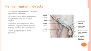 Hernia inguinal indirecta
Se producen lateralmente a los vasos
epigástricos inferiores.
Se pueden deber a una persistencia
congénita anormal del proceso
vaginal.
Adquiridas: son el resultado de la
debilidad progresiva de las paredes
lateral y posterior del canal inguinal.
Tienen que pasar por el anillo
profundo.
 