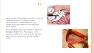 Tx
La cirugía es el único tratamiento con el que se
puede reparar una hernia de manera
permanente. La cirugía puede ser más
riesgosa para pacientes con problemas de
salud graves.
En la operación, se asegura el tejido debilitado
de la pared abdominal (fascia) y se cierra
cualquier agujero. La mayoría de las hernias
se cierran con parches de tela para sellar el
orificio.
 