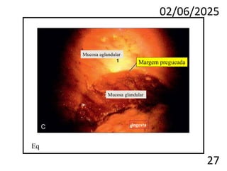 02/06/2025
27
ingesta
Margem pregueada
Mucosa aglandular
Mucosa glandular
Eq
 