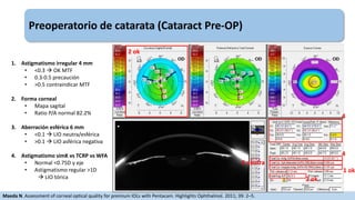 Preoperatorio de catarata (Cataract Pre-OP)
1. Astigmatismo irregular 4 mm
• <0.3  OK MTF
• 0.3-0.5 precaución
• >0.5 con...