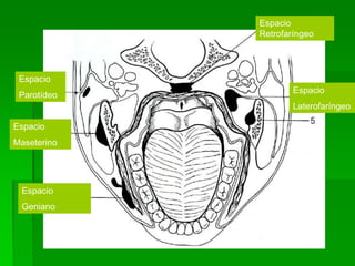 Espacio
             Retrofaríngeo




 Espacio
                     Espacio
 Parotídeo
                     Laterofaríngeo

Espacio
Maseterino




 Espacio
 Geniano
 