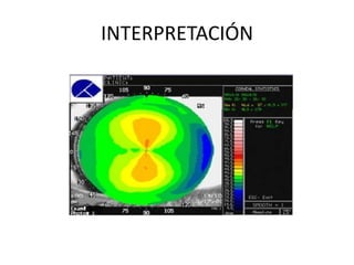 INTERPRETACIÓN
 