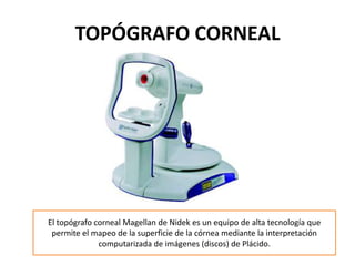 TOPÓGRAFO CORNEAL




El topógrafo corneal Magellan de Nidek es un equipo de alta tecnología que
 permite el mapeo de la superficie de la córnea mediante la interpretación
              computarizada de imágenes (discos) de Plácido.
 