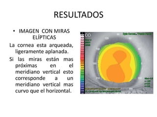 RESULTADOS
  • IMAGEN CON MIRAS
          ELÍPTICAS
La cornea esta arqueada,
   ligeramente aplanada.
Si las miras están mas
   próximas      en      el
   meridiano vertical esto
   corresponde     a    un
   meridiano vertical mas
   curvo que el horizontal.
 
