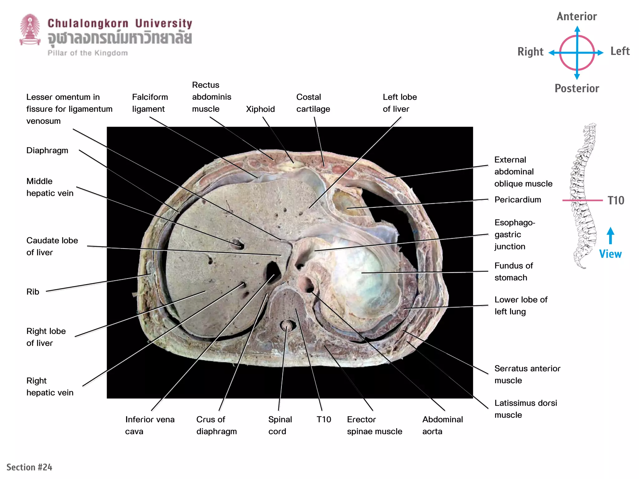 Topographic anatomy of abdomen | PDF