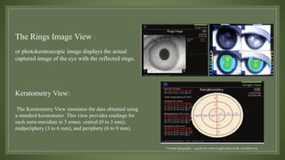 TOPOGRAPHY of cornea (corneal imaging).pptx