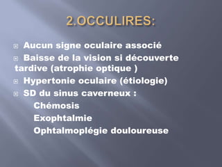 Verre à trois miroires