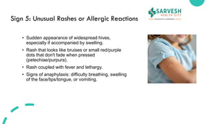 Sentinel Signs Rash Top Signs Your Child Needs to Visit a Pediatrician Immediately.pdf