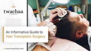 Top things you must know about hair & hair transplant surgeries