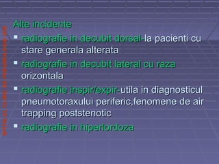 SPITALULCLINICDEPNEUMOLOGIEIASI
Alte incidenteAlte incidente
 radiografie in decubit dorsal-radiografie in decubit dorsal-la pacienti cula pacienti cu
stare generala alteratastare generala alterata
 radiografie in decubit lateral cu razaradiografie in decubit lateral cu raza
orizontalaorizontala
 radiografie inspir/expir-radiografie inspir/expir-utila in diagnosticulutila in diagnosticul
pneumotoraxului periferic,fenomene de airpneumotoraxului periferic,fenomene de air
trapping poststenotictrapping poststenotic
 radiografie in hiperlordozaradiografie in hiperlordoza
 