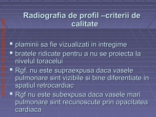 SPITALULCLINICDEPNEUMOLOGIEIASI
Radiografia de profil –criterii deRadiografia de profil –criterii de
calitatecalitate
 plaminii sa fie vizualizati in intregimeplaminii sa fie vizualizati in intregime
 bratele ridicate pentru a nu se proiecta labratele ridicate pentru a nu se proiecta la
nivelul toraceluinivelul toracelui
 Rgf. nu este supraexpusa daca vaseleRgf. nu este supraexpusa daca vasele
pulmonare sint vizibile si bine diferentiate inpulmonare sint vizibile si bine diferentiate in
spatiul retrocardiacspatiul retrocardiac
 Rgf nu este subexpusa daca vasele mariRgf nu este subexpusa daca vasele mari
pulmonare sint recunoscute prin opacitateapulmonare sint recunoscute prin opacitatea
cardiacacardiaca
 