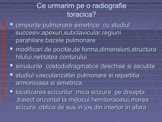 SPITALULCLINICDEPNEUMOLOGIEIASI
 cimpurile pulmonare simetrice cu studiulcimpurile pulmonare simetrice cu studiul
succesiv:apexuri,subclavicular,regiunisuccesiv:apexuri,subclavicular,regiuni
parahilare,bazele pulmonareparahilare,bazele pulmonare
 modificari de pozitie,de forma,dimensiuni,structuramodificari de pozitie,de forma,dimensiuni,structura
hilului,netitatea conturuluihilului,netitatea conturului
 sinusurile costodiafragmatice deschise si ascutitesinusurile costodiafragmatice deschise si ascutite
 studiul vascularizatiei pulmonare si repartitiastudiul vascularizatiei pulmonare si repartitia
armonioasa si simetrica.armonioasa si simetrica.
 localizarea scizurilor :mica scizura pe dreaptalocalizarea scizurilor :mica scizura pe dreapta
,traiect orizontal la mijlocul hemitoracelui,marea,traiect orizontal la mijlocul hemitoracelui,marea
scizura ,oblica de sus in jos,din interior in afarascizura ,oblica de sus in jos,din interior in afara
Ce urmarim pe o radiografie
toracica?
 