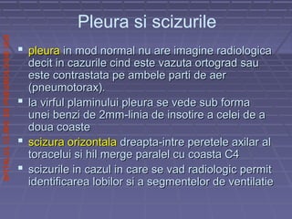 SPITALULCLINICDEPNEUMOLOGIEIASI
 pleurapleura in mod normal nu are imagine radiologicain mod normal nu are imagine radiologica
decit in cazurile cind este vazuta ortograd saudecit in cazurile cind este vazuta ortograd sau
este contrastata pe ambele parti de aereste contrastata pe ambele parti de aer
(pneumotorax).(pneumotorax).
 la virful plaminului pleura se vede sub formala virful plaminului pleura se vede sub forma
unei benzi de 2mm-linia de insotire a celei de aunei benzi de 2mm-linia de insotire a celei de a
doua coastedoua coaste
 scizura orizontalascizura orizontala dreapta-intre peretele axilar aldreapta-intre peretele axilar al
toracelui si hil merge paralel cu coasta C4toracelui si hil merge paralel cu coasta C4
 scizurile in cazul in care se vad radiologic permitscizurile in cazul in care se vad radiologic permit
identificarea lobilor si a segmentelor de ventilatieidentificarea lobilor si a segmentelor de ventilatie
Pleura si scizurile
 