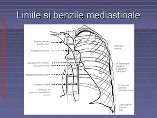 SPITALULCLINICDEPNEUMOLOGIEIASI
Liniile si benzile mediastinaleLiniile si benzile mediastinale
 