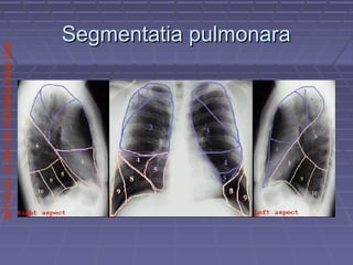 SPITALULCLINICDEPNEUMOLOGIEIASI
Segmentatia pulmonaraSegmentatia pulmonara
 