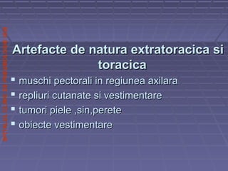 SPITALULCLINICDEPNEUMOLOGIEIASI
Artefacte de natura extratoracica siArtefacte de natura extratoracica si
toracicatoracica
 muschi pectorali in regiunea axilaramuschi pectorali in regiunea axilara
 repliuri cutanate si vestimentarerepliuri cutanate si vestimentare
 tumori piele ,sin,peretetumori piele ,sin,perete
 obiecte vestimentareobiecte vestimentare
 