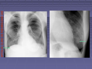 SPITALULCLINICDEPNEUMOLOGIEIASI
 