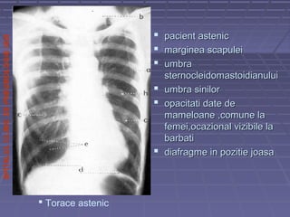 SPITALULCLINICDEPNEUMOLOGIEIASI
 pacient astenicpacient astenic
 marginea scapuleimarginea scapulei
 umbraumbra
sternocleidomastoidianuluisternocleidomastoidianului
 umbra sinilorumbra sinilor
 opacitati date deopacitati date de
mameloane ,comune lamameloane ,comune la
femei,ocazional vizibile lafemei,ocazional vizibile la
barbatibarbati
 diafragme in pozitie joasadiafragme in pozitie joasa
 Torace astenic
 