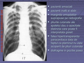 SPITALULCLINICDEPNEUMOLOGIEIASI
 pacientii emaciatipacientii emaciati
 pacienti inalti si slabipacienti inalti si slabi
 marginile omoplatilormarginile omoplatilor
suprapuse pe radiografiesuprapuse pe radiografie
 pliurile cutanate alepliurile cutanate ale
spatelui dau o opacitatespatelui dau o opacitate
distincta care poate fidistincta care poate fi
interpretata gresitinterpretata gresit
 falsa hipertransparentafalsa hipertransparenta
paracardiaca data deparacardiaca data de
faptul ca plaminul nu estefaptul ca plaminul nu este
acoperit de pliuri cutanateacoperit de pliuri cutanate
 diafragme in pozitie joasadiafragme in pozitie joasa
 