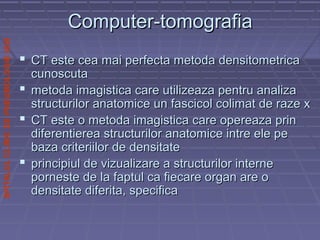 SPITALULCLINICDEPNEUMOLOGIEIASI
Computer-tomografiaComputer-tomografia
 CT este cea mai perfecta metoda densitometricaCT este cea mai perfecta metoda densitometrica
cunoscutacunoscuta
 metoda imagistica care utilizeaza pentru analizametoda imagistica care utilizeaza pentru analiza
structurilor anatomice un fascicol colimat de raze xstructurilor anatomice un fascicol colimat de raze x
 CT este o metoda imagistica care opereaza prinCT este o metoda imagistica care opereaza prin
diferentierea structurilor anatomice intre ele pediferentierea structurilor anatomice intre ele pe
baza criteriilor de densitatebaza criteriilor de densitate
 principiul de vizualizare a structurilor interneprincipiul de vizualizare a structurilor interne
porneste de la faptul ca fiecare organ are oporneste de la faptul ca fiecare organ are o
densitate diferita, specificadensitate diferita, specifica
 
