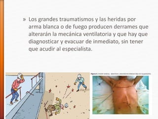 » Los grandes traumatismos y las heridas por
arma blanca o de fuego producen derrames que
alterarán la mecánica ventilatoria y que hay que
diagnosticar y evacuar de inmediato, sin tener
que acudir al especialista.
 