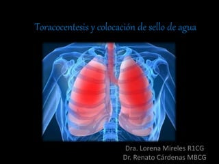 Toracocentesis y colocación de sello de agua
Dra. Lorena Mireles R1CG
Dr. Renato Cárdenas MBCG
 