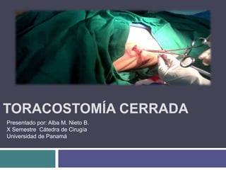 TORACOSTOMÍA CERRADA
Presentado por: Alba M. Nieto B.
X Semestre Cátedra de Cirugía
Universidad de Panamá
 