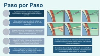 Paso por Paso
Inyecte anestésico local en la piel tejido
subcutáneo y periostio de la costilla, y pleura
parietal
Sebe aspirar la jeringa antes de colocar la
lidocaína para evitar la inyección en un vaso
sanguíneo
Se debe calcular la profundidad de inserción del
tubo para que todos los orificios del tubo estén
dentro del espacio pleural
Se realiza una incisión en la dirección de la
costilla de 2-4 cm. Puede ser ligeramente por
debajo del nivel para que el tubo quede en
posición oblicua para evitar escapes.
Con una pinza hemostática se abre y se
comienza a disecar de manera roma el tejido,
cerrando y abriendo la pinza.
Luego, se explora con el dedo para encontrar el borde
superior que marca el limite inferior del EIC. Se vuelve a
infiltrar de anestésico.
Se continúa disecando, preferiblemente con una Kelly y
con cuidado de no perforar el paquete vasculo nervioso
que esta en el borde inferior de la costilla.
 