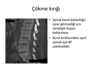 Çökme kırığı
       • Spinal kanal bütünlüğü
         zarar görmediği için
         nörolojik lezyon
         beklenmez.
       • Burst kırıklarından ayırt
         etmek için BT
         çekilmelidir.
 