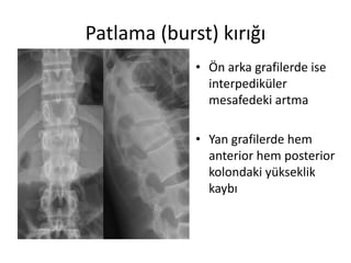 Patlama (burst) kırığı
             • Ön arka grafilerde ise
               interpediküler
               mesafedeki artma

             • Yan grafilerde hem
               anterior hem posterior
               kolondaki yükseklik
               kaybı
 